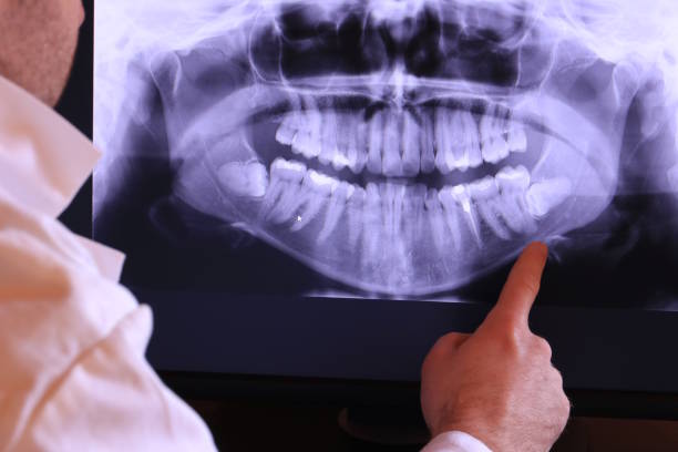 Teeth Whitening in MN