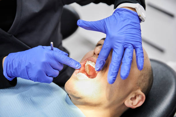 Best Knocked-Out Tooth Emergency  in Dayton, MN